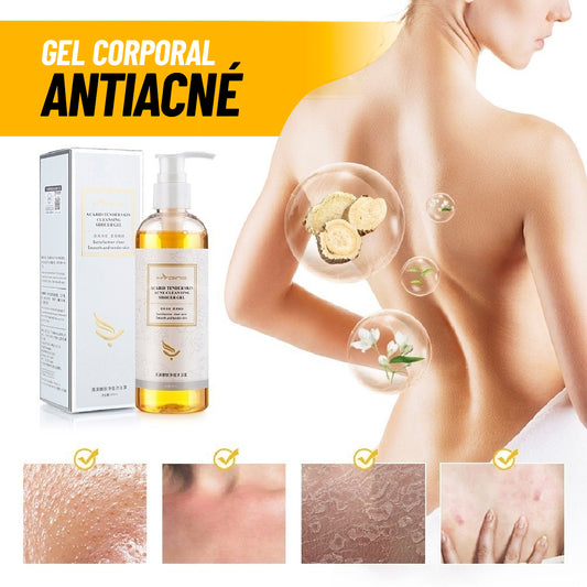 Gel Corporal Antiacné