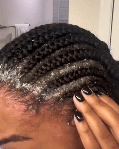 Shampoo Zero Caspa PROMOCION